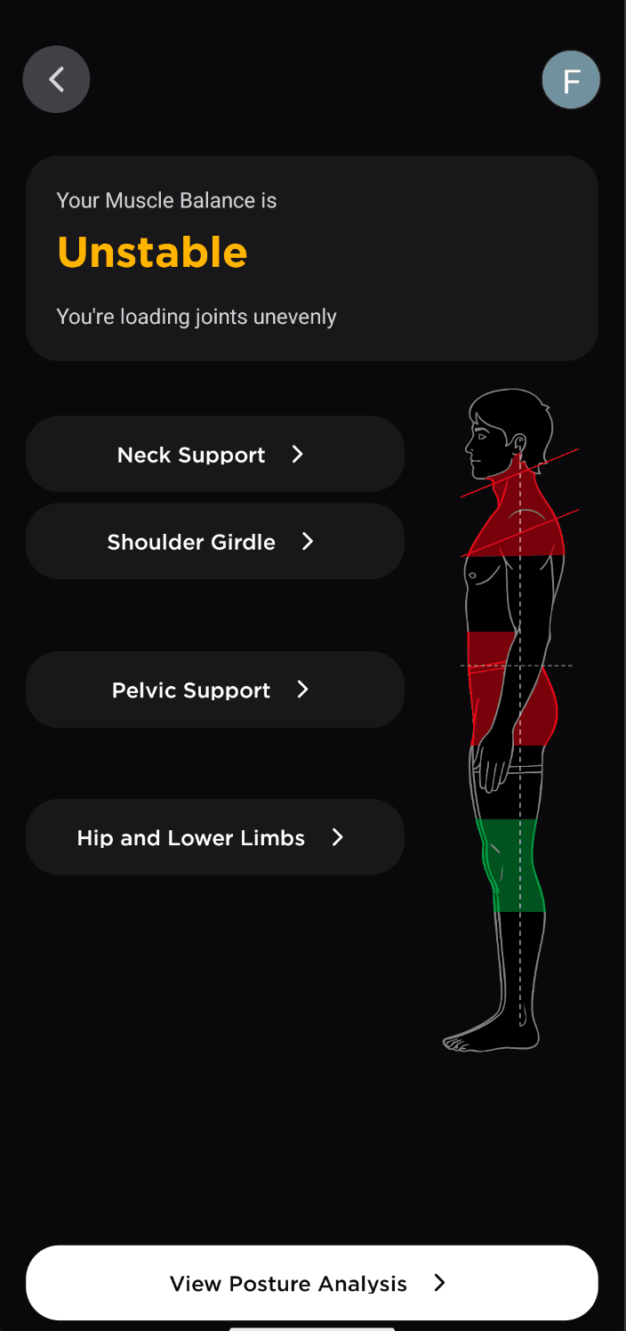 Mithrion app — muscle balance analysis showing imbalance regions across the body